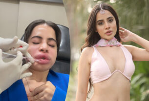 Tragedy for the actress in search of artificial beauty