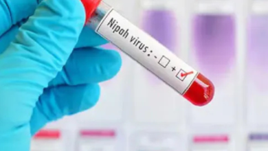 Nipah Virus is a zoonotic virus carried by fruit bats and transmitted through contaminated food or close human contact.